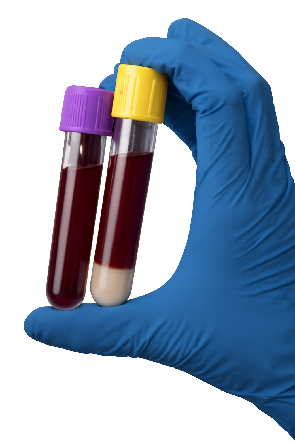Blood sample collection vials